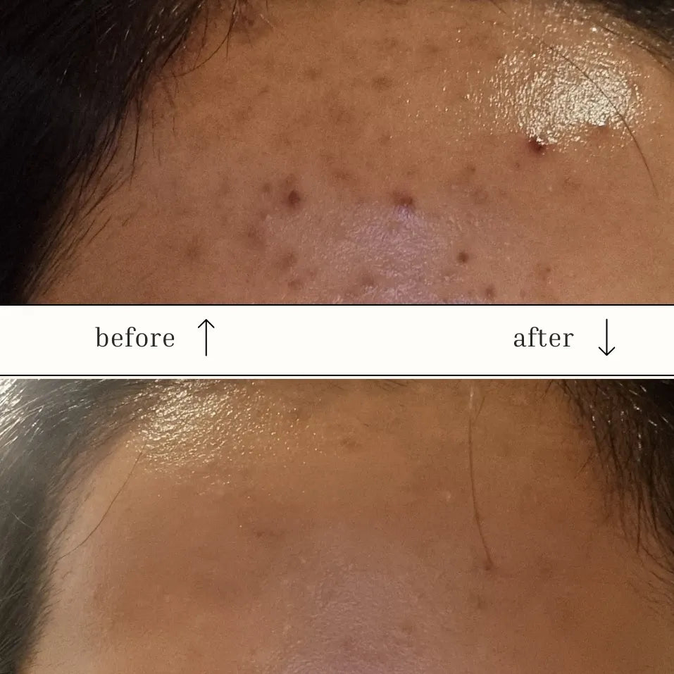 valencian vitamin C serum image 2